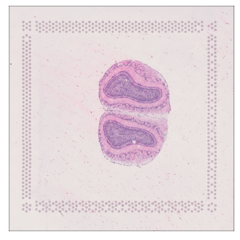 ../_images/examples_visium_10x_20_0.png