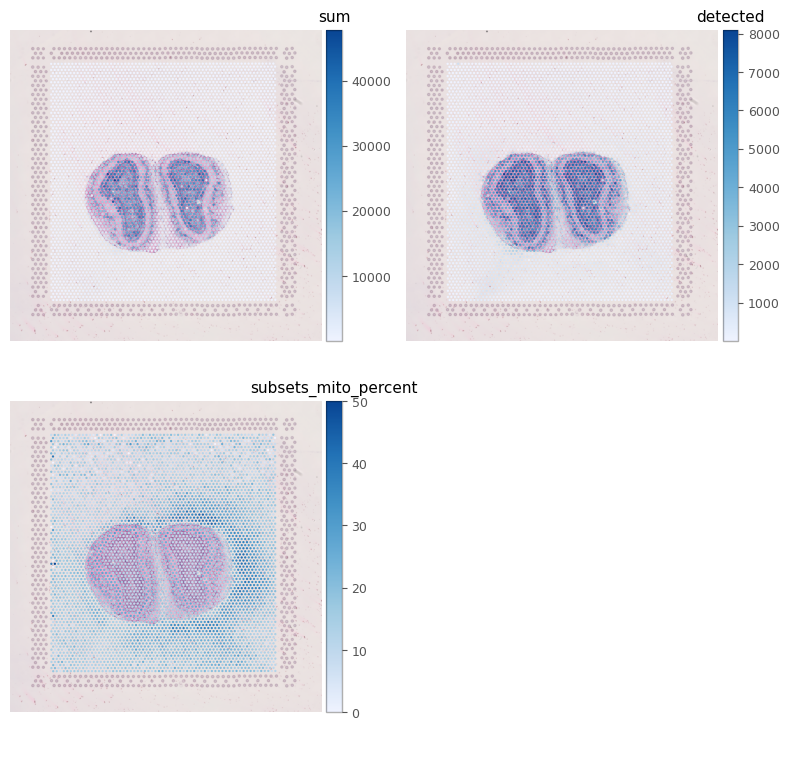 ../_images/examples_visium_10x_29_0.png